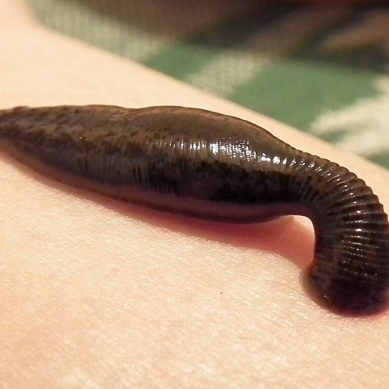 Leech Therapy